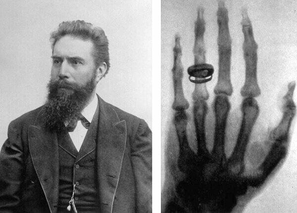 The X Factor: 125 Years of X-Ray Innovation